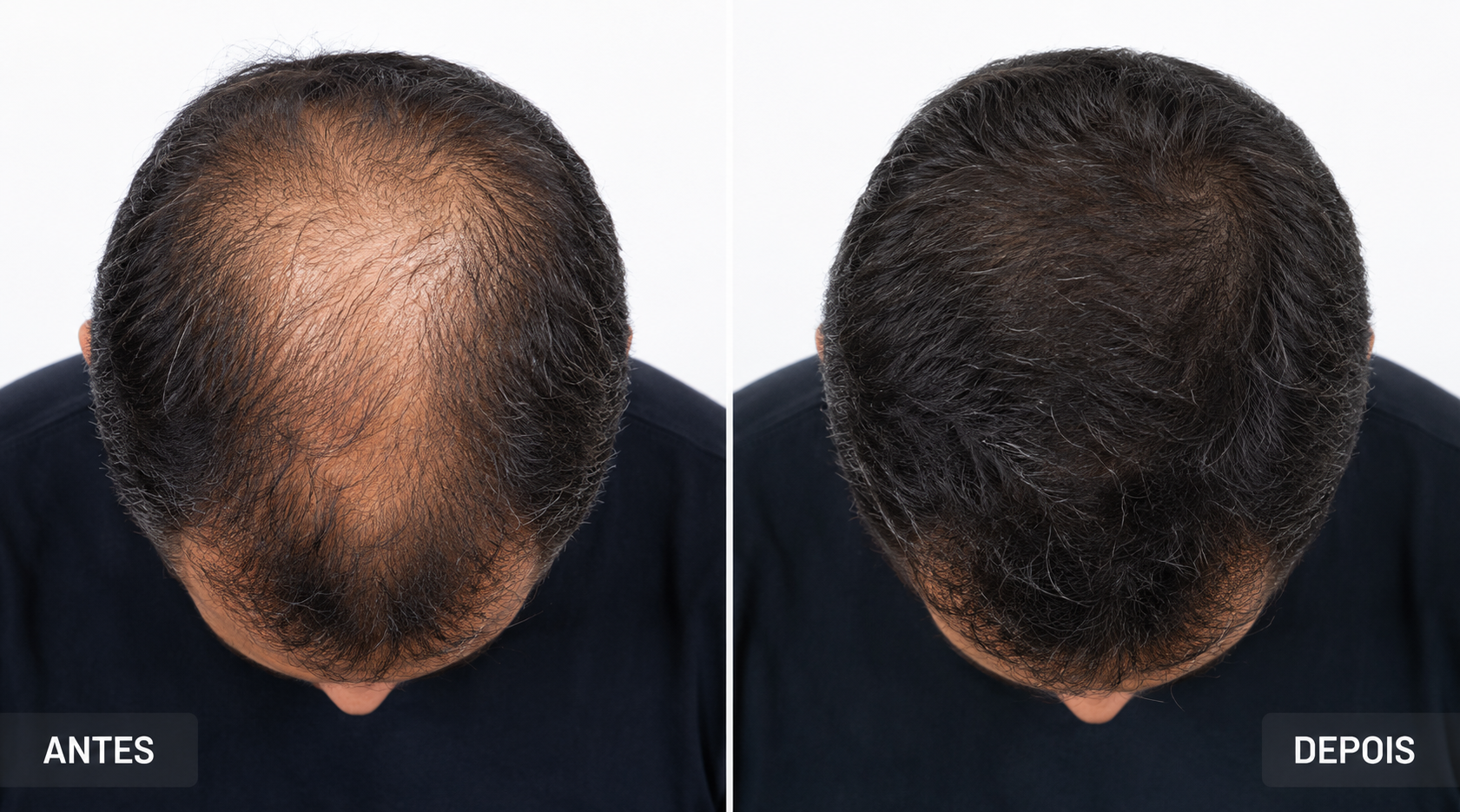 LumiGrow Cap result — John, 47 — London