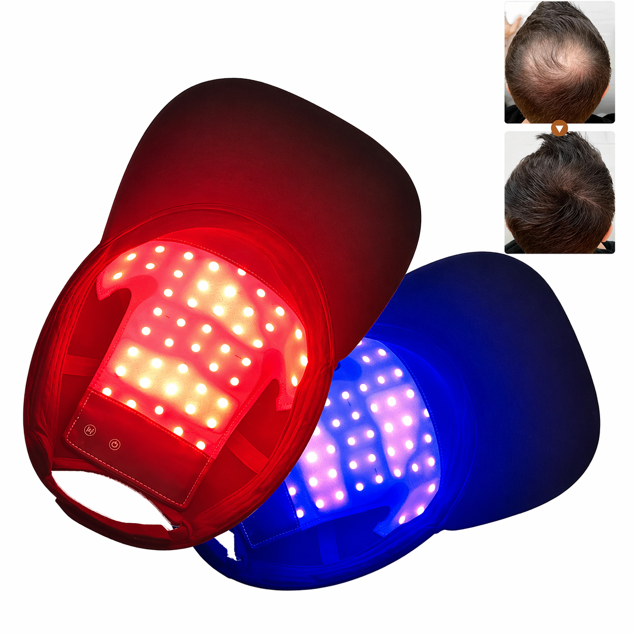 LumiGrow Cap — LED Hair Cap